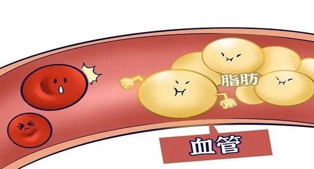 怎样有效避免产后高血脂？