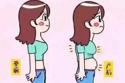 【健康科普】产后恢复全攻略，请收藏好！