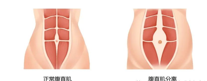 产后恢复这7个方面，宝妈们一定要重视