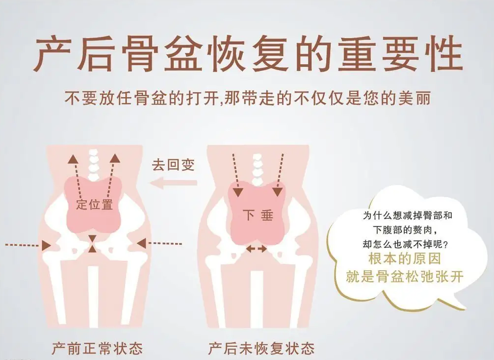 产后修复的重要性